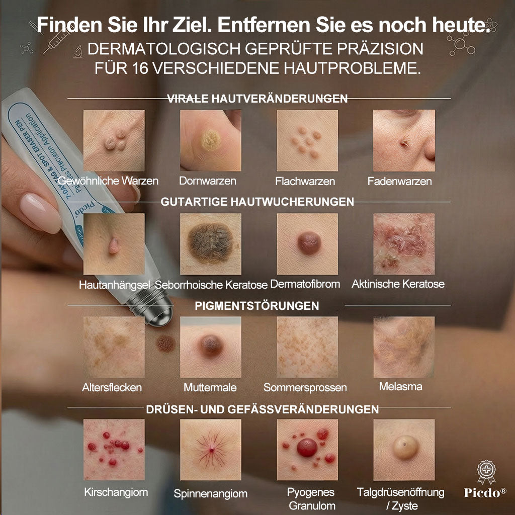 🥝7-𝐓𝒂𝒈𝒆 𝐇𝒂𝒖𝒕𝒂𝒏𝒉ä𝒏𝒈𝒔𝒆𝒍- & 𝐅𝒍𝒆𝒄𝒌𝒆𝒏𝒆𝒏𝒕𝒇𝒆𝒓𝒏𝒆𝒓